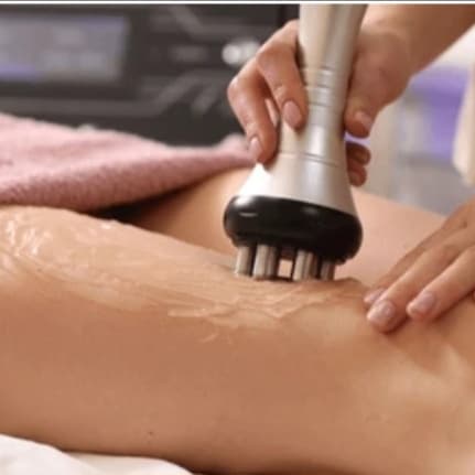 Cellulite RF 6-Session Thighs at Lovinme Smoother Silhouette in Murrieta, CA
