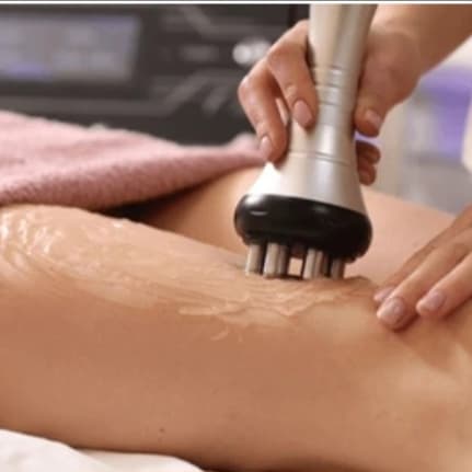 Cellulite RF 3-Session Thighs at Lovinme Smoother Silhouette in Murrieta, CA